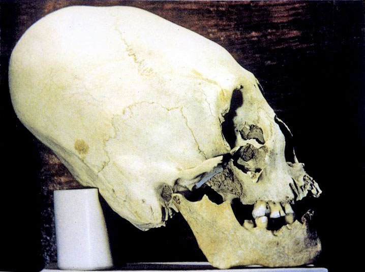 annunaki-skull