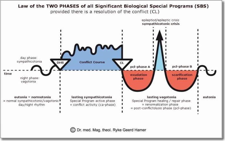 Dr Hamer Disease Chart